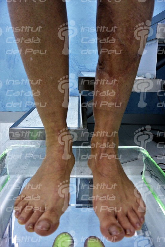 El tejido cicatricial: características.