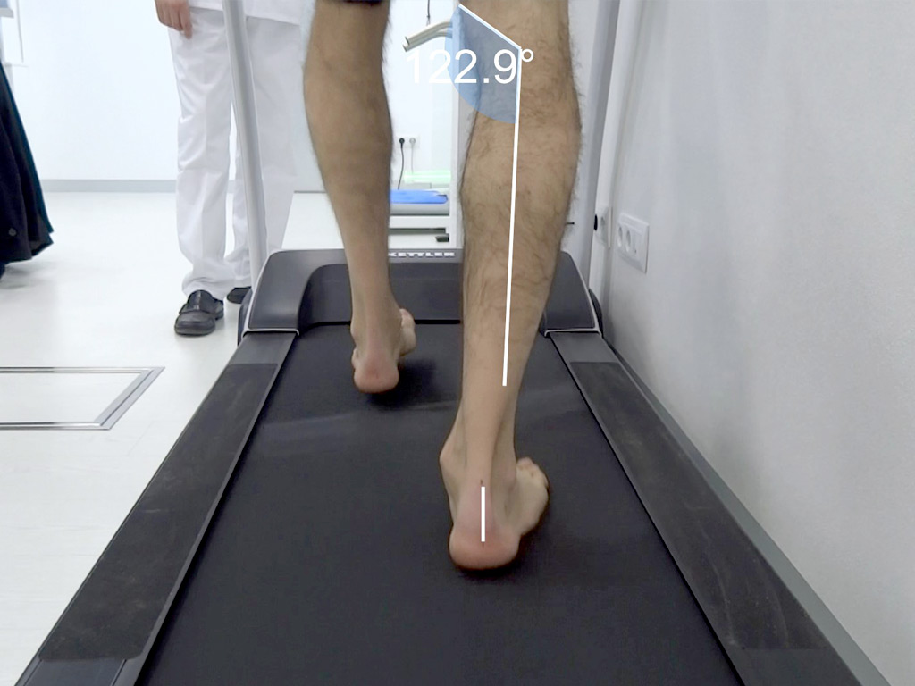 Estudios Biomecánicos