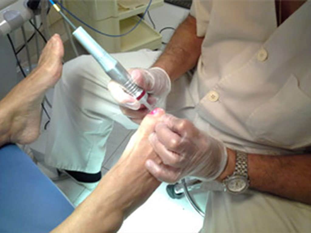 Alteraciones Dermatológicas