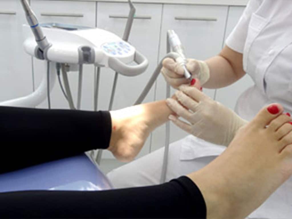 Alteraciones Dermatológicas