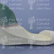 The agenesis in the lower extremity