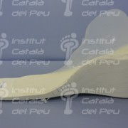 The agenesis in the lower extremity