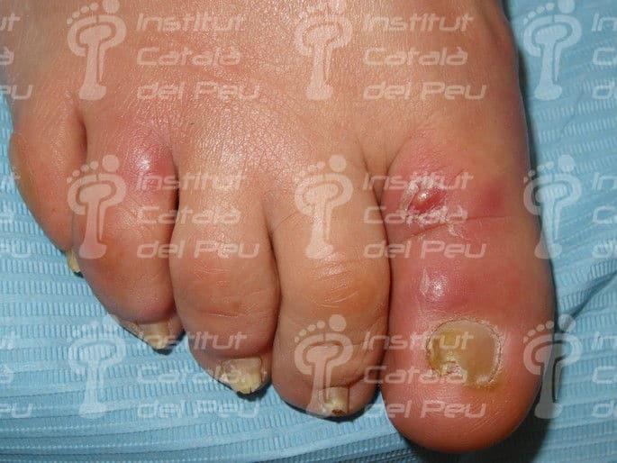 Alteraciones Dermatológicas