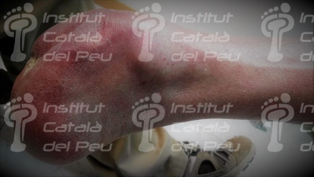 Ortopodología Ortopedia